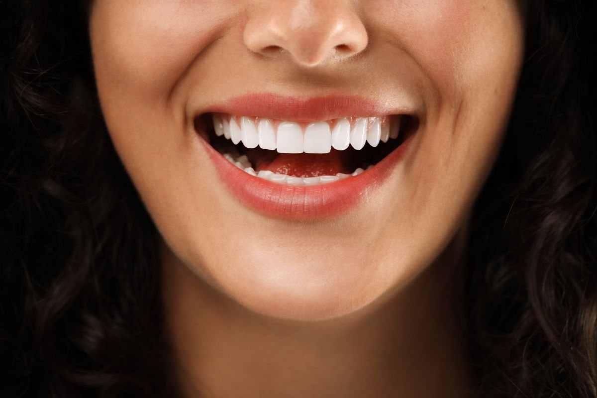 Estética Dental1