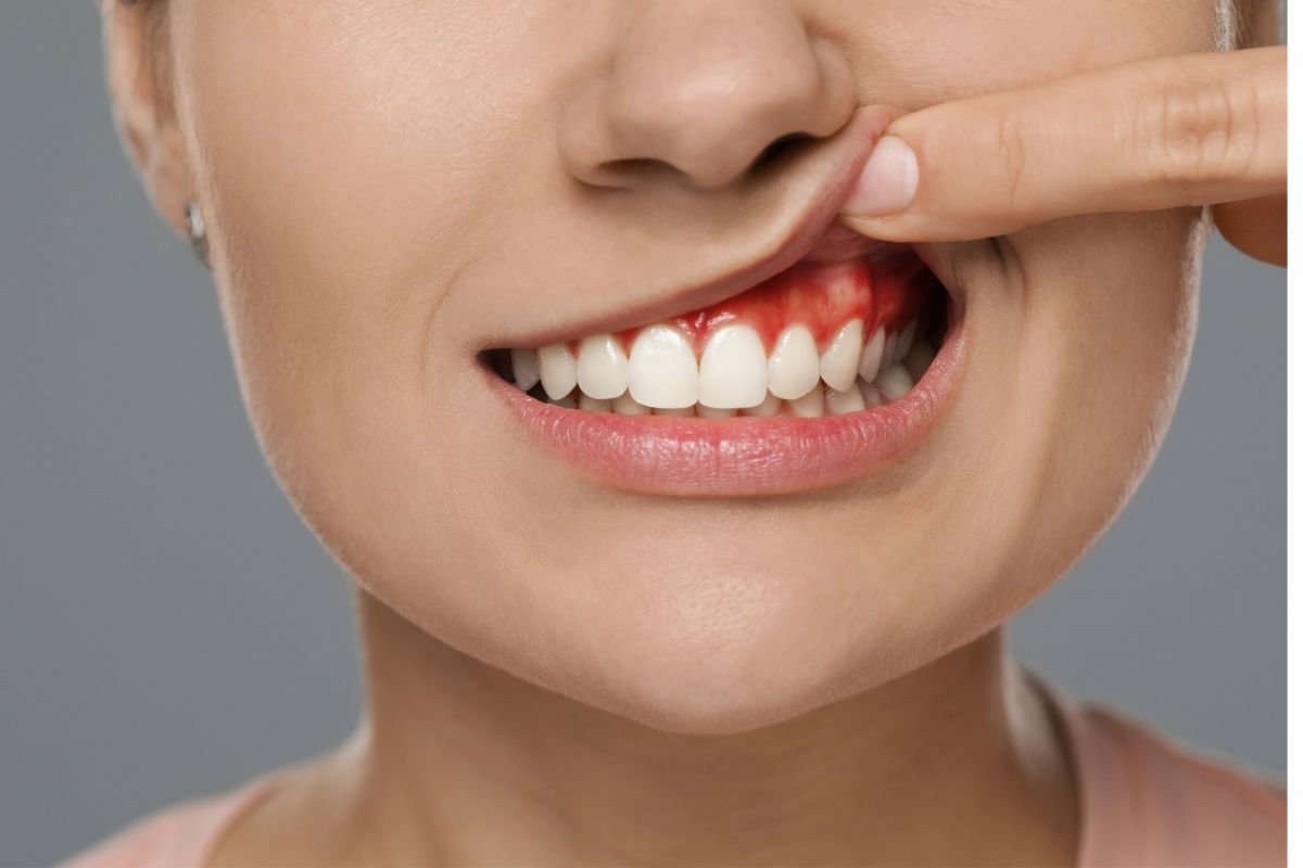 Periodoncia1