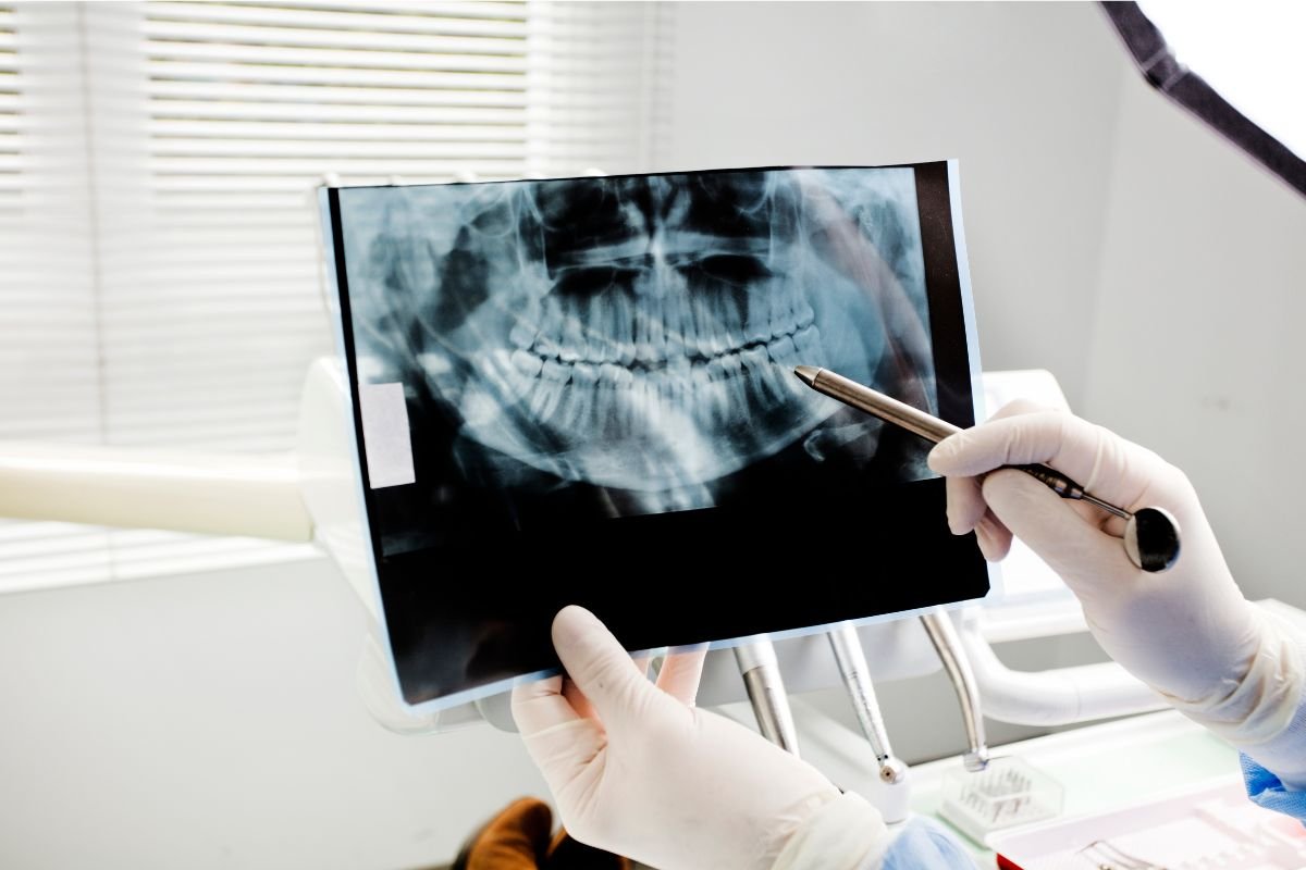 Rehabilitación Oral2